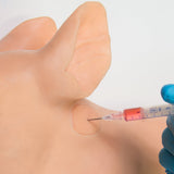 Injection Module Value Pack - Weany