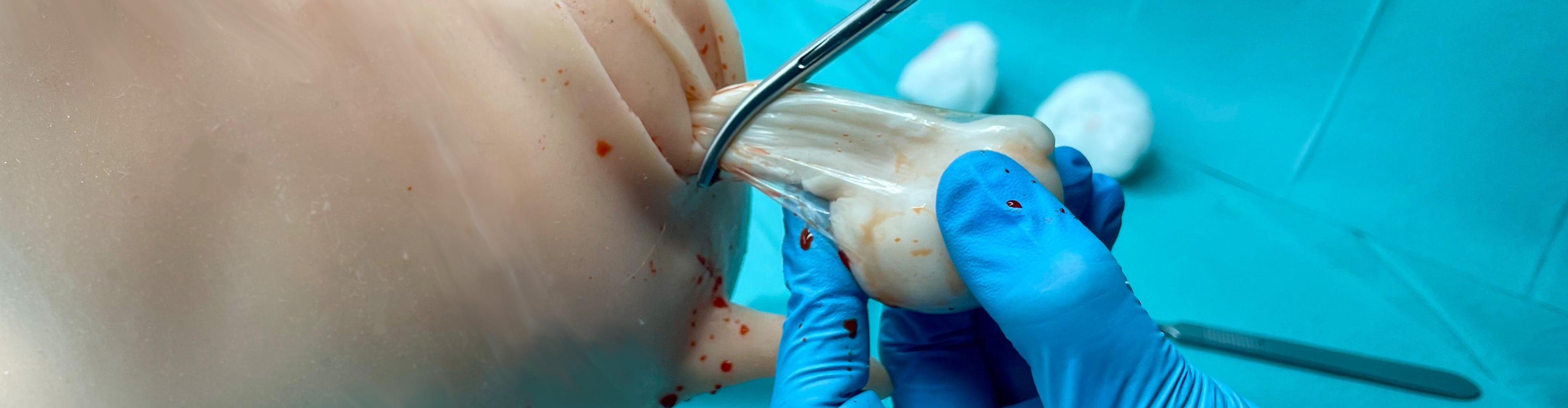 Chirurgie