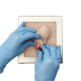 Castration Module - Castro