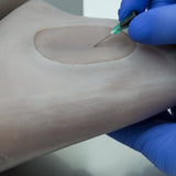 Femoral vein - Rita