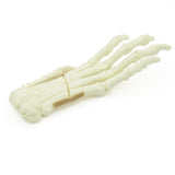 Forefoot Metacarpal Fx | Dog
