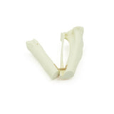 Tibia short oblique Fx | Dog