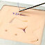 Thumb: Wound Suture Pad