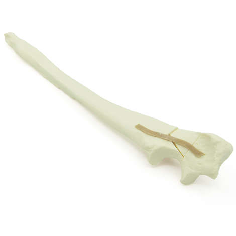 Ulna mit Trümmerfraktur am Olekranon - Hund (solide)
