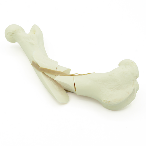 Femur mit Trümmerfraktur - Hund (solide)