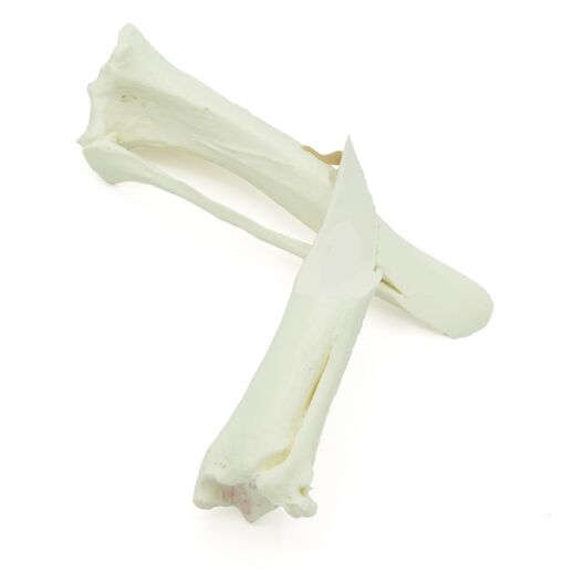 Canine Tibia With Spiral Fracture (solid)