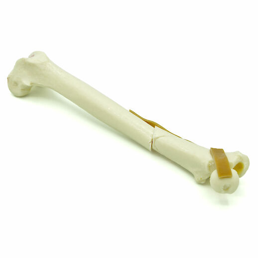Feline Femur with femoral neck fracture and comminuted fracture (solid)
